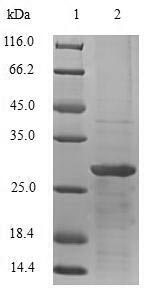 Human TSHB protein