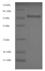 Human UCHL5 protein