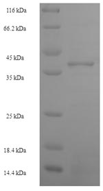 Human ZNF581 protein