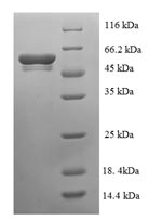 E. coli alaC protein