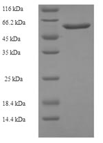 E. coli nrdB protein
