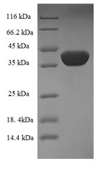 E. coli nfsA protein