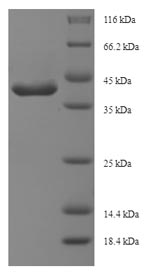 E.coli tcyA protein