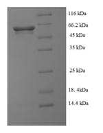 E.coli gluD protein