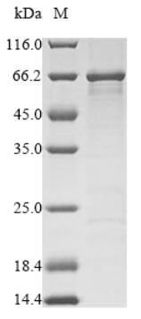 E.coli P30996 protein