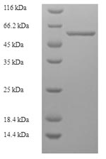 Human Capsid VP2 protein