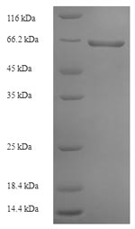 Rabies virus Glycoprotein