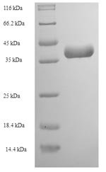E.coli SVTLE protein