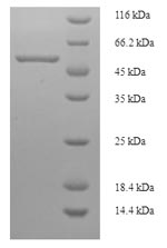 E.coli scaIM protein