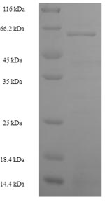 Human SKP2 protein