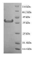Human MAD2L1 protein