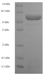 Human SART3 protein