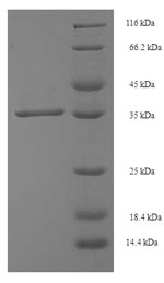 Human SMUG1 protein