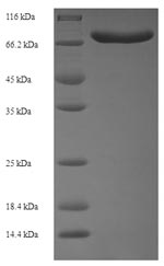 Human ACBD5 protein