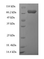 Human ATG16L1 protein