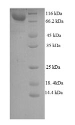 Mouse Wdpcp protein
