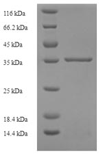 Human IL29 protein