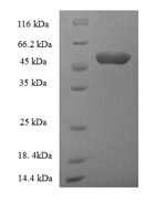 Human ACBD4 protein