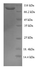 Human GCC1 protein