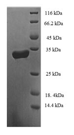 Human DTD2 protein