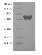 Human PDCD10 protein