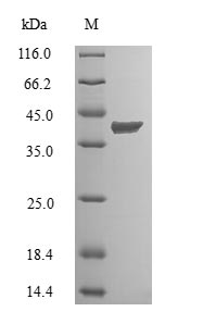 Human CINP protein