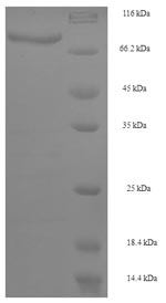 Human CYP4F11 protein