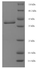 Human MIS12 protein