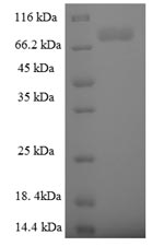 Human TRIM9 protein