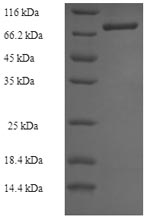 Human Q9NNW7 protein
