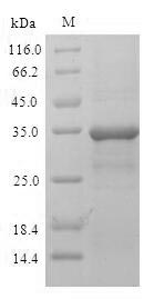 Human MCTS1 protein