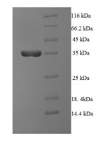 Human PPP2R3B protein