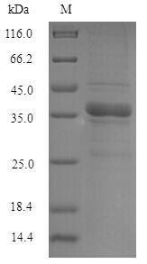 Human NIP7 protein
