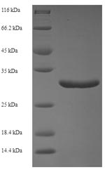 Human CALML5 protein