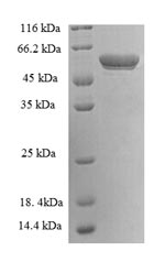 Human YWHAH protein