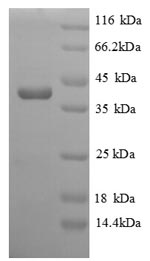 E.coli MHT1 protein