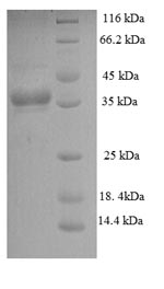 E.coli pstS1 protein