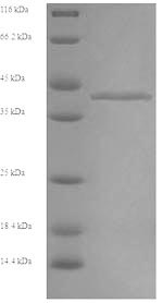 Yeast ALDOB protein
