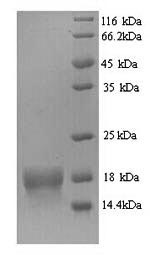 Human ATP5D protein