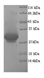 Human DNM1 protein