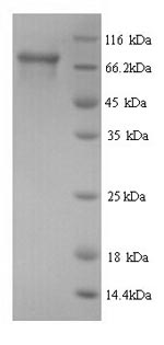 Human HSD17B4 protein