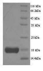 Human IL2 protein