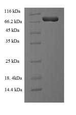 Human LCP1 protein