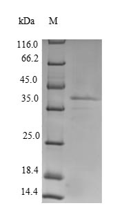 Rat LHCGR protein