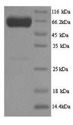 Human PKLR protein