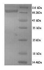 Human RRM1 protein