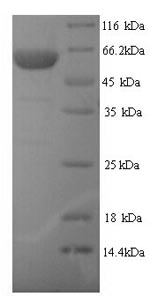 Human TRIM21 protein