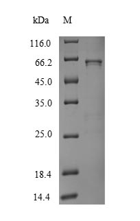 Human UGT1A1 protein