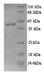 Yeast GCY1 protein