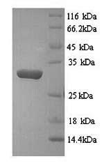 Yeast aroD protein